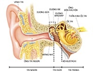 VIÊM TAI GIỮA CẤP